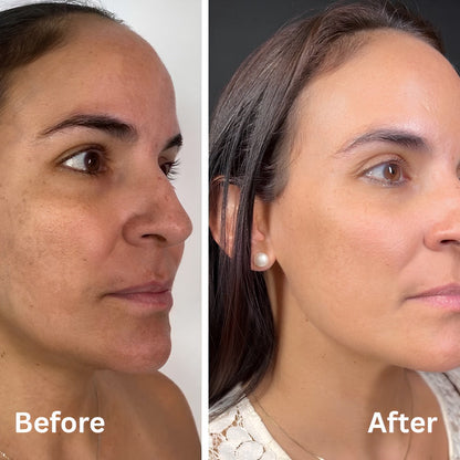 Dr. Melaxin Peel Shot Bundle