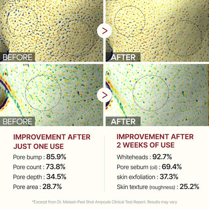 Dr. Melaxin Peel Shot Bundle