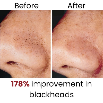 Dr. Melaxin Peel Shot Bundle